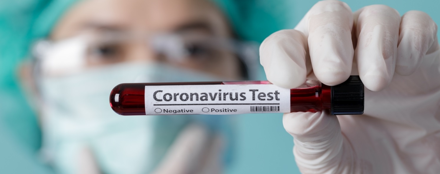 coronavirus