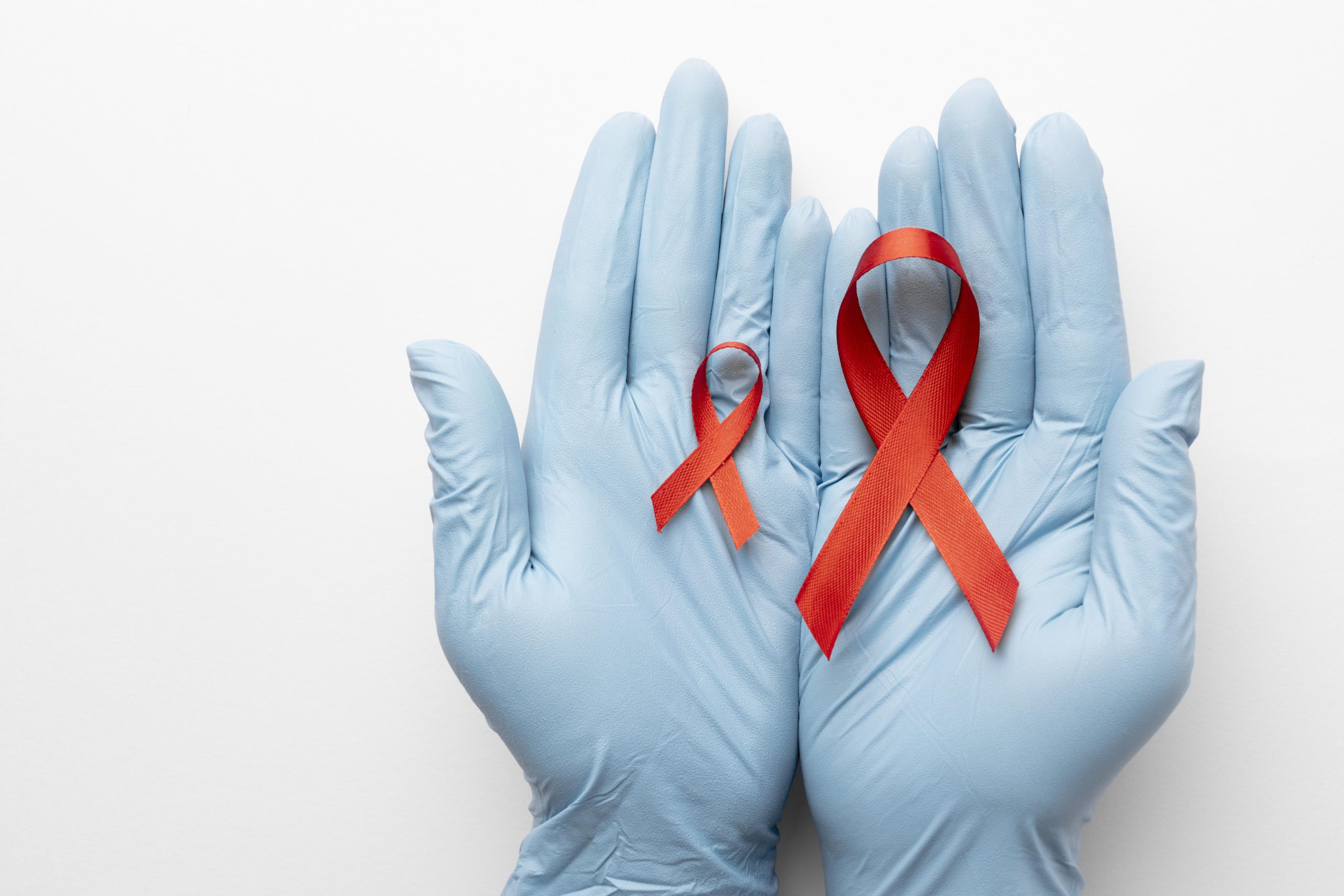 SIDA: aprenda cómo prevenirlo